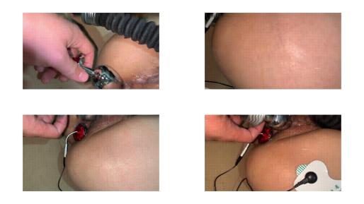 稀缺资源字母圈调教大神actor44426g完整第弹母狗各种虐阴虐菊啪啪花样多手法奇特360