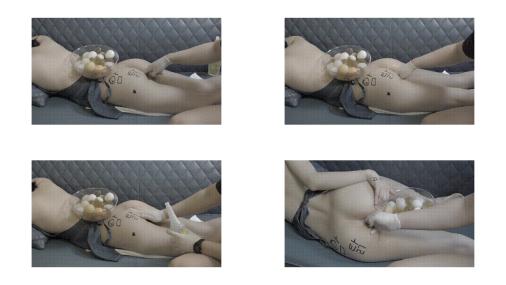 [肛门_鸡蛋]重口肛门调教，棒子妹妹这么美的屁股被调教用来生蛋蛋，这样也对，把菊花的功能开发一下。2v